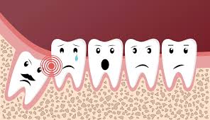 Nagu Super Speciality Dental Clinic - Latest update - Wisdom Teeth Removal Treatment Channapatana