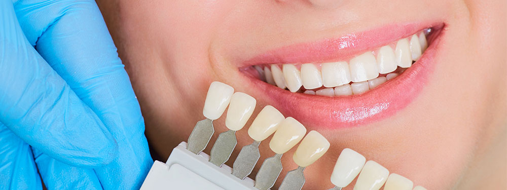 Nagu Super Speciality Dental Clinic - Latest update - Teeth Whitening in Channapatna