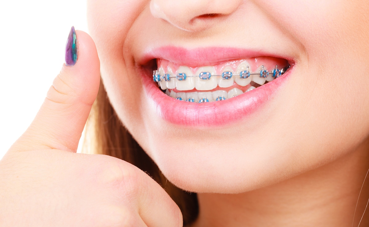 Nagu Super Speciality Dental Clinic - Latest update - Orthodontics Treatment in Channapatana