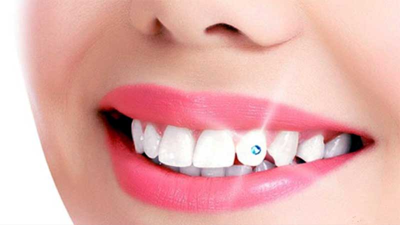 Nagu Super Speciality Dental Clinic - Latest update - COSMETIC DENTAL IN CHANNAPATANA