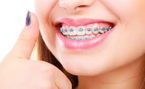 Nagu Super Speciality Dental Clinic - Latest update - Orthodontics Treatment in Channapatana