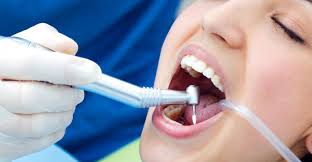 Nagu Super Speciality Dental Clinic - Latest update - Root Canal Treatment in Channapatna