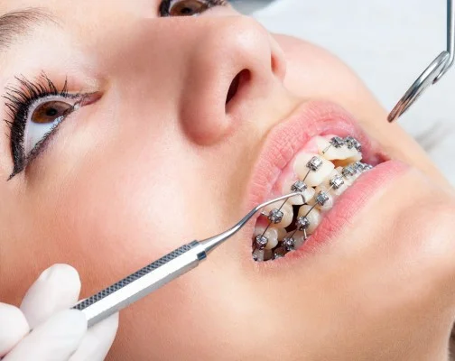 Nagu Super Speciality Dental Clinic - Latest update - Orthodontics Treatment in Channapatana