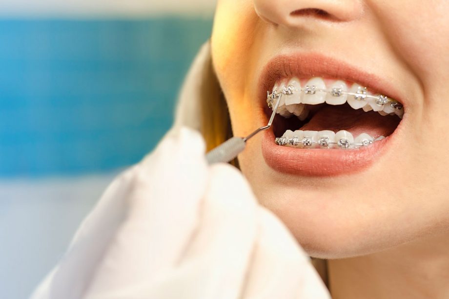 Nagu Super Speciality Dental Clinic - Latest update - ORTHODONTICS IN Channapatna