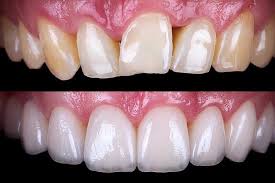 Album - Cosmetic Dentistry